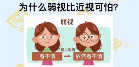 為什么弱視比近視可怕？