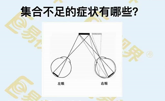 集合不足的癥狀有哪些？